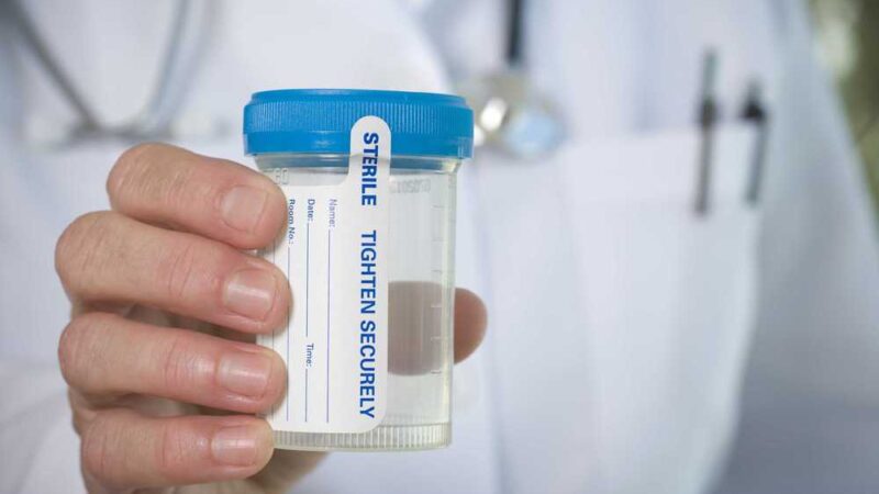 Drug Test Welfare Recipients